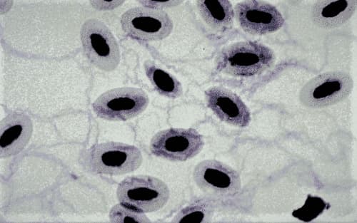 Borrellia anserina