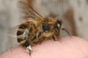 puntura vespa shock anafilattico